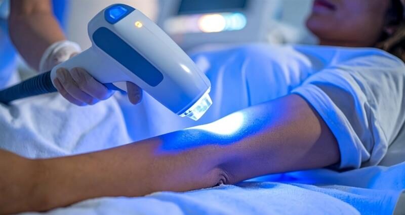 professional laser hair treatment